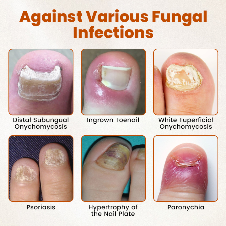 Timilk® BeeGuard Antifungal Drops