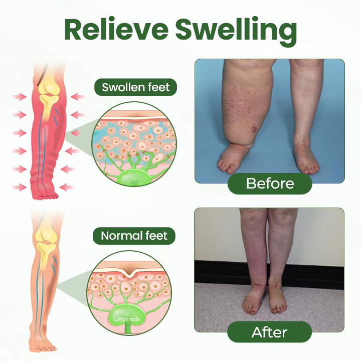 Timilk® BodyRelief Circulation Cream