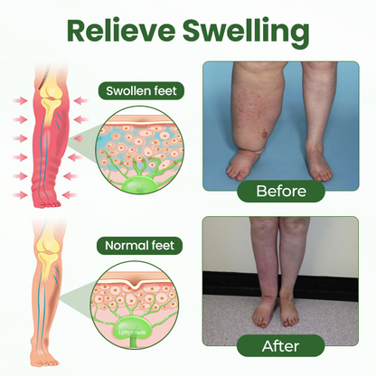 Timilk® BodyRelief Circulation Cream