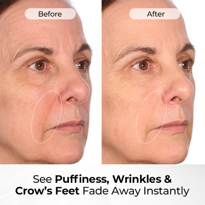 Biancat® TightShift Precision Contour & Firming Serum