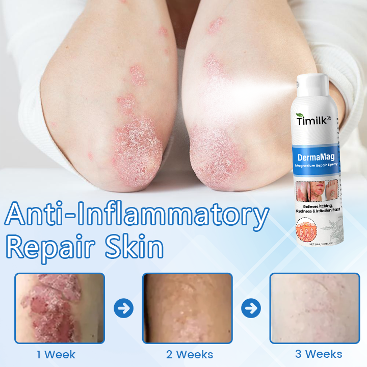 Timilk® DermaMag Magnesium Repair Spray 💝