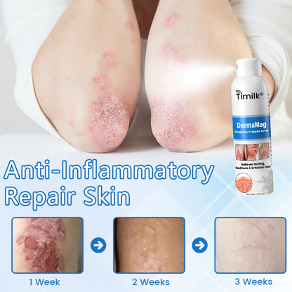 Timilk® DermaMag Magnesium Repair Spray 💝