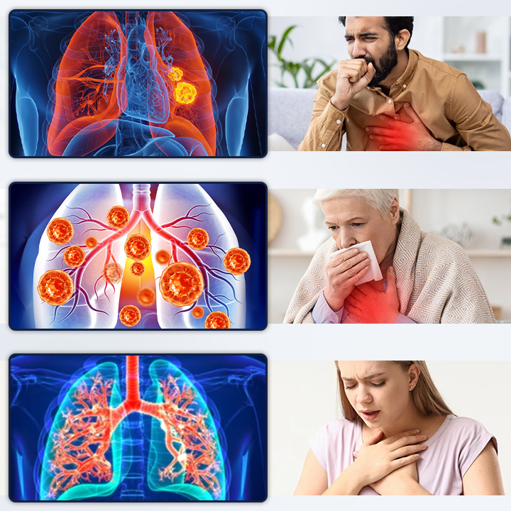 Timilk® PureBreath Lung Support Patch