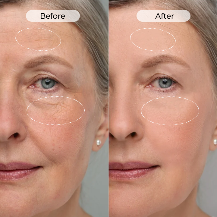 Biancat® TightShift Precision Contour & Firming Serum