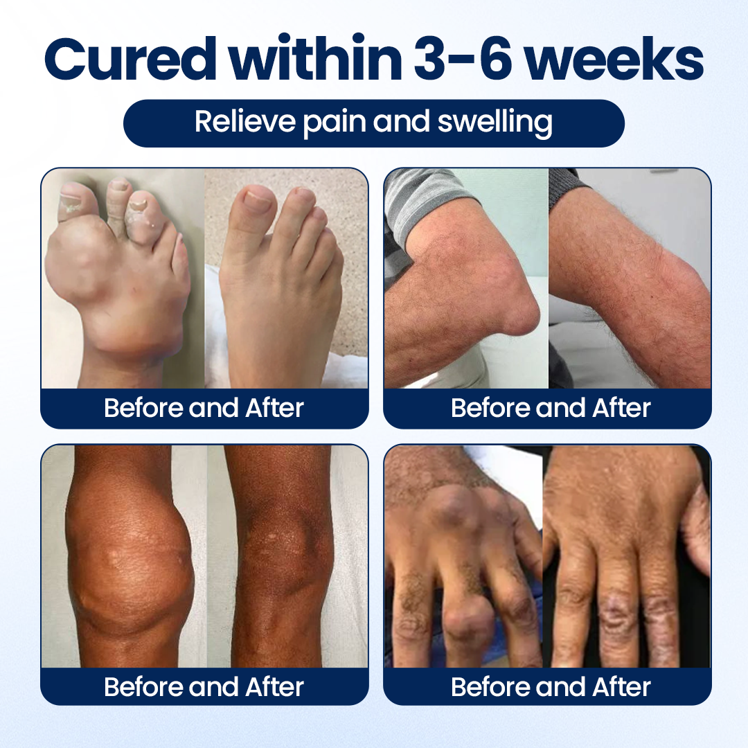 Timilk® ArthriNAD+ Pro Advanced Joint Recovery Cream