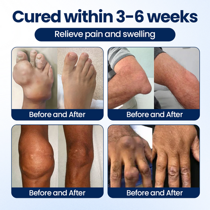Timilk® ArthriNAD+ Pro Advanced Joint Recovery Cream