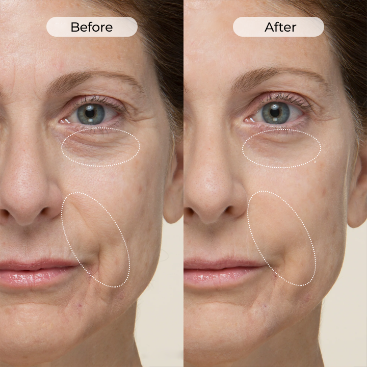 Biancat® TightShift Precision Contour & Firming Serum