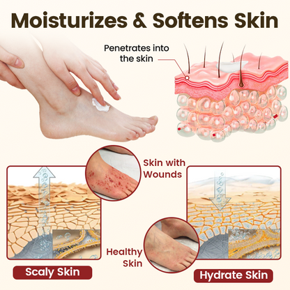 Timilk® DiaRelief Healing Cream