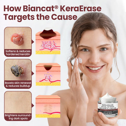 Biancat®KeraErase Dual-Action Renewal Cream