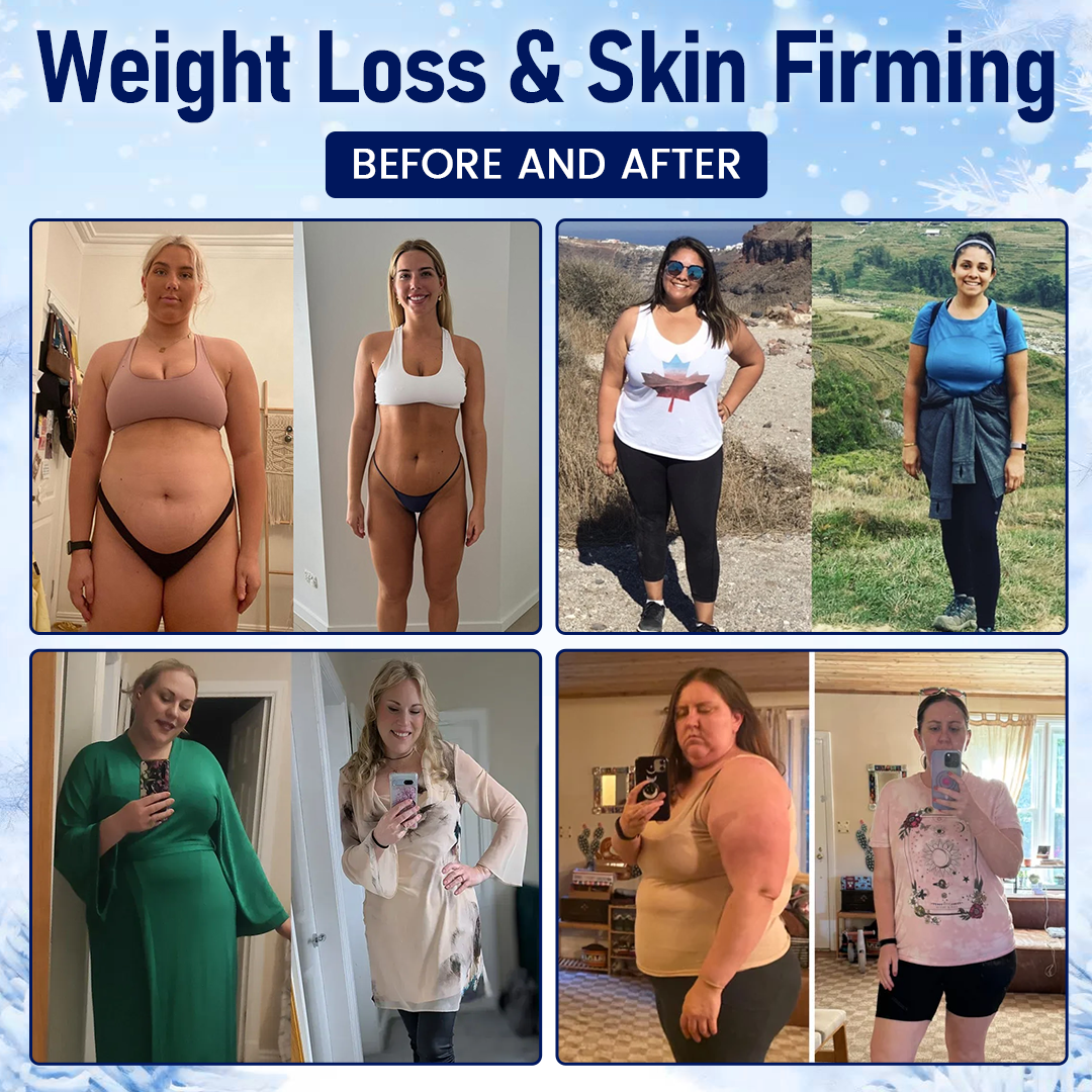 Ceoerty® CryoContour 4-in-1 Body Sculpting Mist