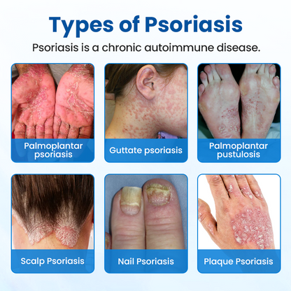 Timilk® Magnesium Herbal Treatment Spray