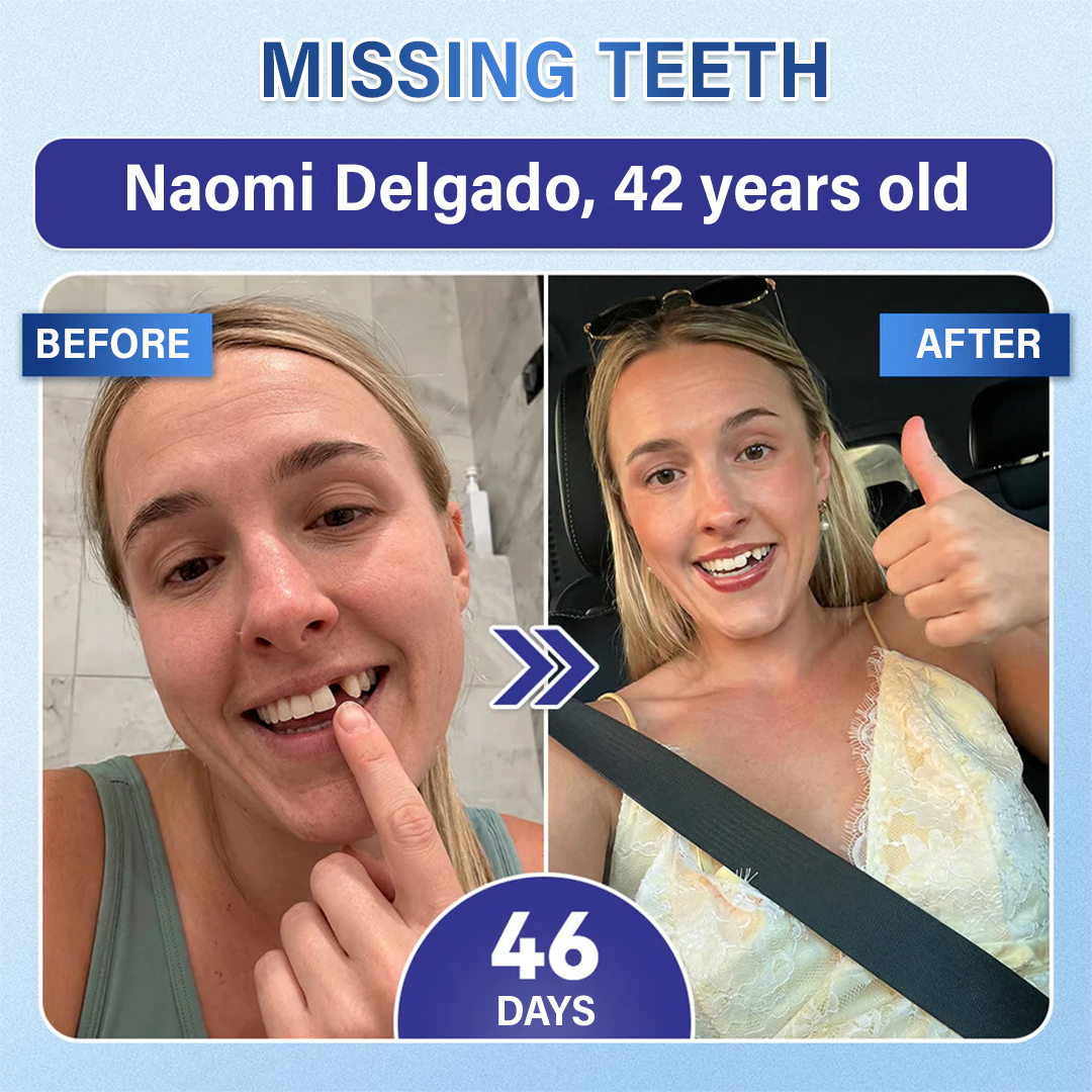 Your Smile🦷Ceoerty® Tooth & Gum Repair Fast-Dissolving Microneedle Patch✨ (𝟓-𝐢𝐧-𝟏 💎 𝐑𝐞𝐛𝐮𝐢𝐥𝐝 𝐄𝐧𝐚𝐦𝐞𝐥 & 𝐃𝐞𝐧𝐭𝐢𝐧 • 𝐒𝐭𝐫𝐞𝐧𝐠𝐭𝐡𝐞𝐧 𝐆𝐮𝐦𝐬 • 𝐄𝐫𝐚𝐝𝐢𝐜𝐚𝐭𝐞 𝐓𝐚𝐫𝐭𝐚𝐫 & 𝐎𝐝𝐨𝐫 • 𝐖𝐡𝐢𝐭𝐞𝐧𝐢𝐧𝐠 • 𝐒𝐭𝐨𝐩 𝐓𝐨𝐨𝐭𝐡 𝐒𝐞𝐧𝐬𝐢𝐭𝐢𝐯𝐢𝐭𝐲)