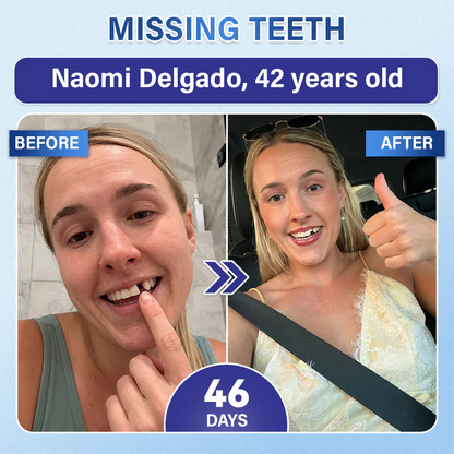 Your Smile🦷Ceoerty® Tooth & Gum Repair Fast-Dissolving Microneedle Patch✨ (𝟓-𝐢𝐧-𝟏 💎 𝐑𝐞𝐛𝐮𝐢𝐥𝐝 𝐄𝐧𝐚𝐦𝐞𝐥 & 𝐃𝐞𝐧𝐭𝐢𝐧 • 𝐒𝐭𝐫𝐞𝐧𝐠𝐭𝐡𝐞𝐧 𝐆𝐮𝐦𝐬 • 𝐄𝐫𝐚𝐝𝐢𝐜𝐚𝐭𝐞 𝐓𝐚𝐫𝐭𝐚𝐫 & 𝐎𝐝𝐨𝐫 • 𝐖𝐡𝐢𝐭𝐞𝐧𝐢𝐧𝐠 • 𝐒𝐭𝐨𝐩 𝐓𝐨𝐨𝐭𝐡 𝐒𝐞𝐧𝐬𝐢𝐭𝐢𝐯𝐢𝐭𝐲)