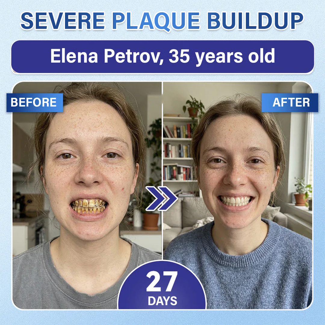 Your Smile🦷Ceoerty® Tooth & Gum Repair Fast-Dissolving Microneedle Patch✨ (𝟓-𝐢𝐧-𝟏 💎 𝐑𝐞𝐛𝐮𝐢𝐥𝐝 𝐄𝐧𝐚𝐦𝐞𝐥 & 𝐃𝐞𝐧𝐭𝐢𝐧 • 𝐒𝐭𝐫𝐞𝐧𝐠𝐭𝐡𝐞𝐧 𝐆𝐮𝐦𝐬 • 𝐄𝐫𝐚𝐝𝐢𝐜𝐚𝐭𝐞 𝐓𝐚𝐫𝐭𝐚𝐫 & 𝐎𝐝𝐨𝐫 • 𝐖𝐡𝐢𝐭𝐞𝐧𝐢𝐧𝐠 • 𝐒𝐭𝐨𝐩 𝐓𝐨𝐨𝐭𝐡 𝐒𝐞𝐧𝐬𝐢𝐭𝐢𝐯𝐢𝐭𝐲)