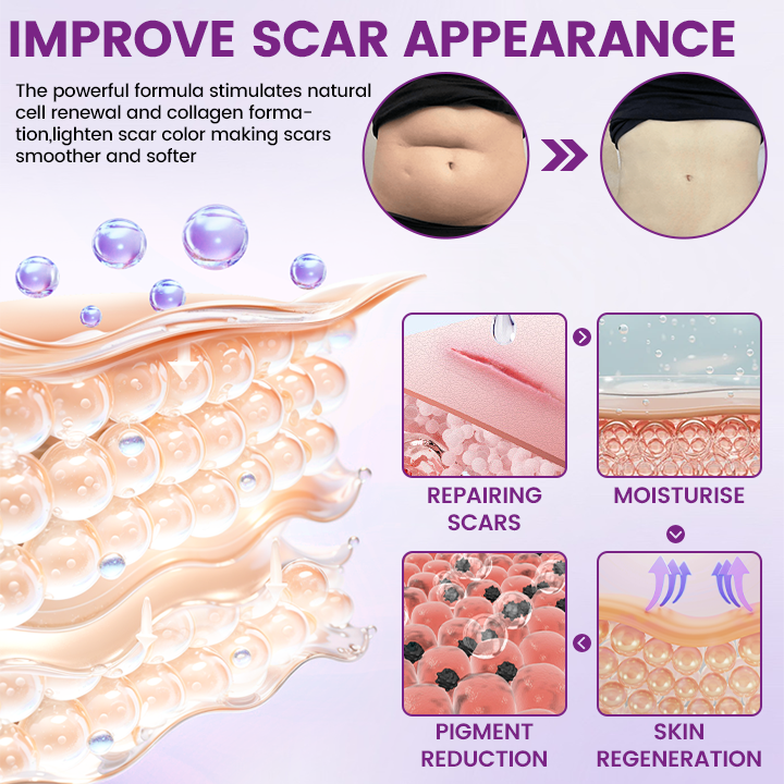 Timilk® ScarVanisher Scar Gel that Visibly Reduces Scars & Stretch Marks in 2 Weeks