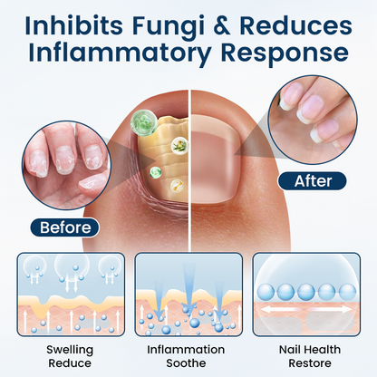 Timilk® OnyxiGuard Fungal Repair Herbal Spray