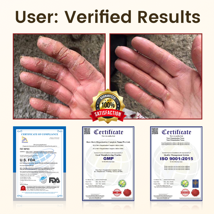 Timilk® DiaRelief Healing Cream