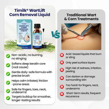Timilk® WartLift Corn Removal Liquid 💝