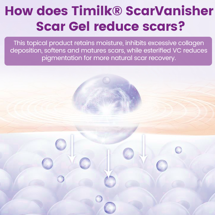 Timilk® ScarVanisher Scar Gel that Visibly Reduces Scars & Stretch Marks in 2 Weeks