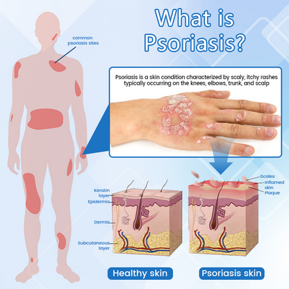 Timilk® DermaMag Magnesium Repair Spray 💝