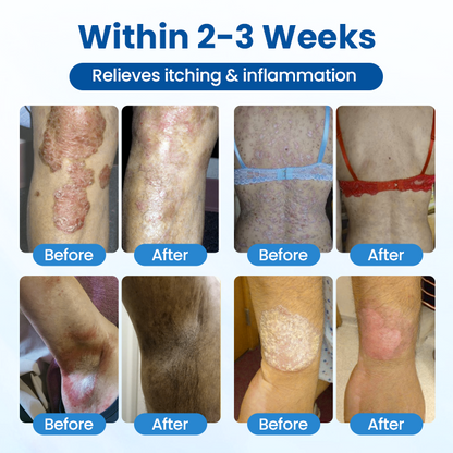 Timilk® Magnesium Herbal Treatment Spray