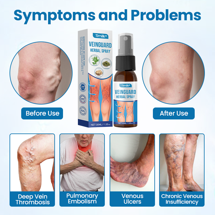 Timilk® VeinGuard Herbal Spray-