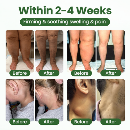 Timilk® BodyRelief Circulation Cream