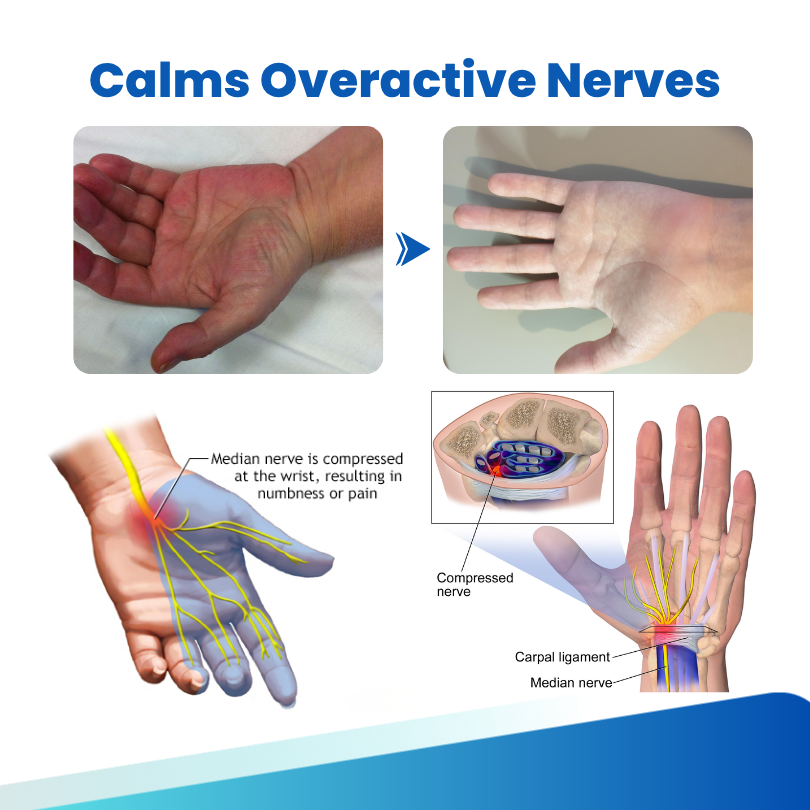 Timilk® NerveRelief Neuropathy Treatment Spray