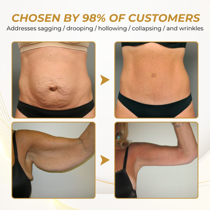 Timilk® FirmFlora Skin Lifting Cream