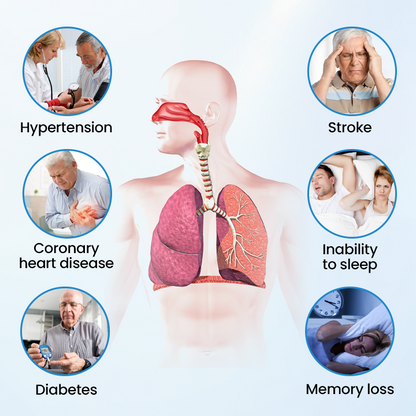 Timilk® SnoreLess Nasal Breather