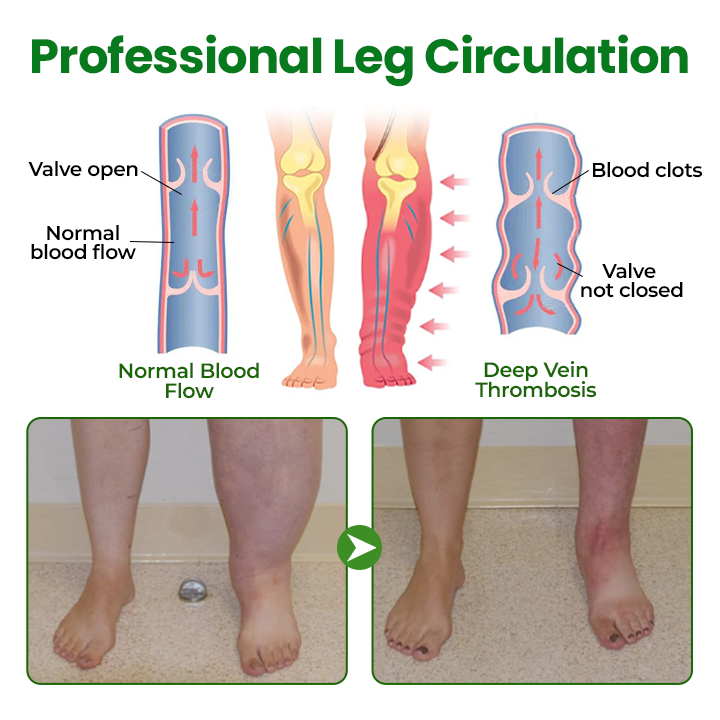 Timilk® VenoLift Leg Relief Spray