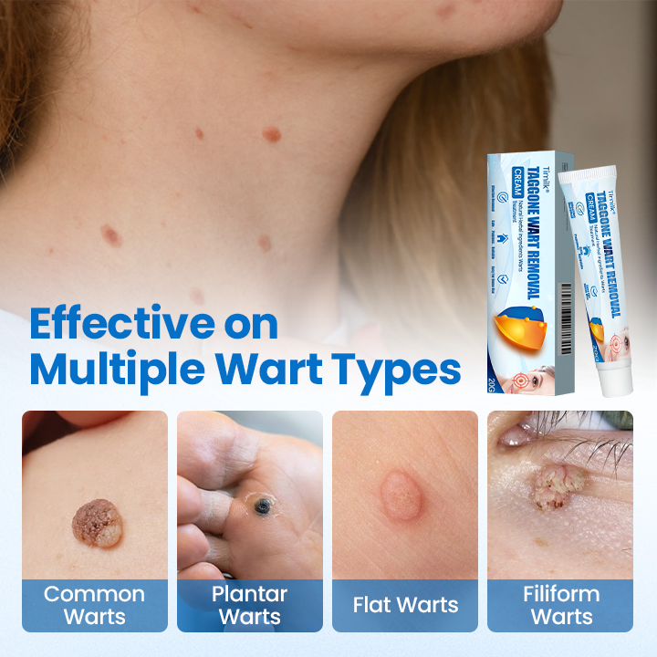 Timilk® TagGone Wart Removal Cream 💝